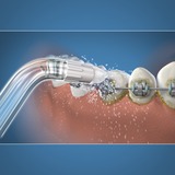 Waterpik OD-100 Orthodontische Tip opzetstuk 2 stuks